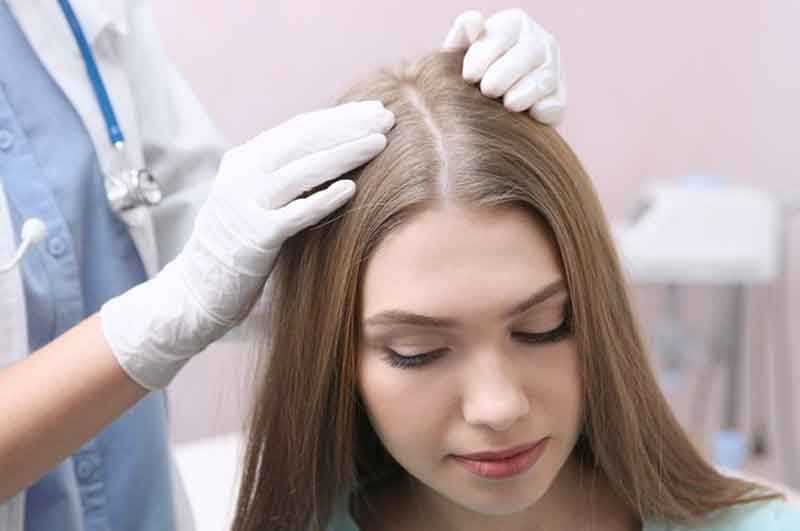 Botulinumtoxin und androgenetische Alopezie (anlagebedingter Haarausfall)?