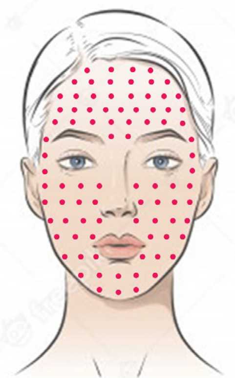 Mikrobotox: Gesichtsverjüngung und Facelifting	