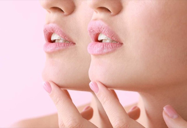 Das untere Gesichtsdrittel – Hyaluronsäure und Botulinumtoxin Typ A